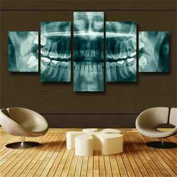 Рентгеновский снимок зубов Стоматолога, 5 частей холста, настенный художественный плакат, домашний декор, HD Печать фотографий Без рамок, 5 панелей, декор комнаты